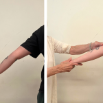 The image is a split of two pictures of an arm - the left is hyperextended and the right is being aided by AT teaching hands.