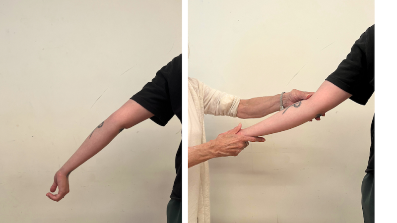 The image is a split of two pictures of an arm - the left is hyperextended and the right is being aided by AT teaching hands.